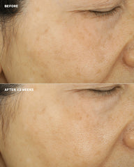 even better™ brightening essence lotion