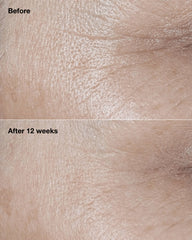 clinique smart clinical repair™ broad spectrum spf 30 wrinkle correcting cream