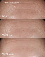 anti-aging skincare bundle