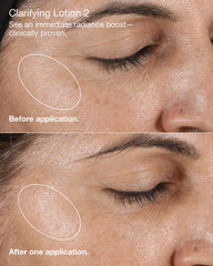 3-step routine bundle for dry combination skin