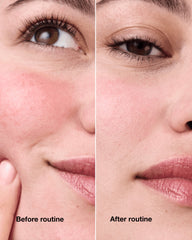 redness solutions redness regimen