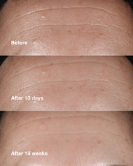 clinique smart clinical repair™ wrinkle correcting serum