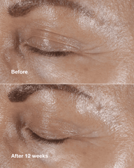 clinique smart clinical repair™ wrinkle correcting eye cream