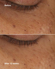 all about eyes™ brightening serum concentrate