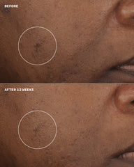 even better clinical™ brightening moisturizer