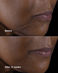 clinique smart clinical repair™ lifting face + neck cream