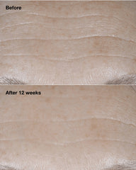 clinique smart clinical repair™ broad spectrum spf 30 wrinkle correcting cream