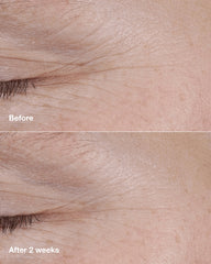 clinique smart clinical repair™ am/pm retinoid balm