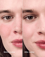 redness solutions redness regimen