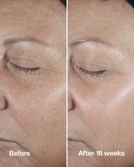 clinique smart clinical repair™ wrinkle correcting serum