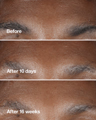 clinique smart clinical repair™ wrinkle correcting serum