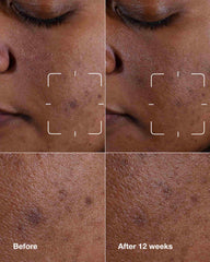 even better clinical™ dark spot clearing serum