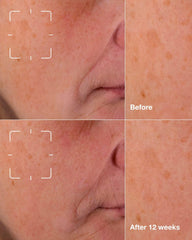 even better clinical™ dark spot clearing serum